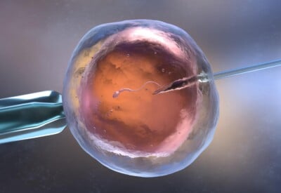 IVF