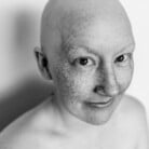 Grey and white photo of paige with no hair