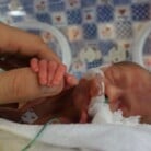 Premature baby